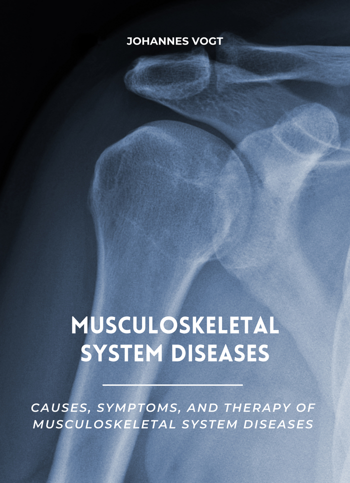 Musculoskeletal System Diseases