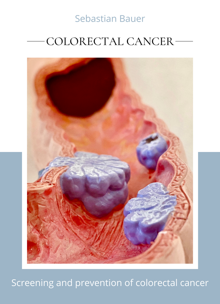 Colorectal Cancer