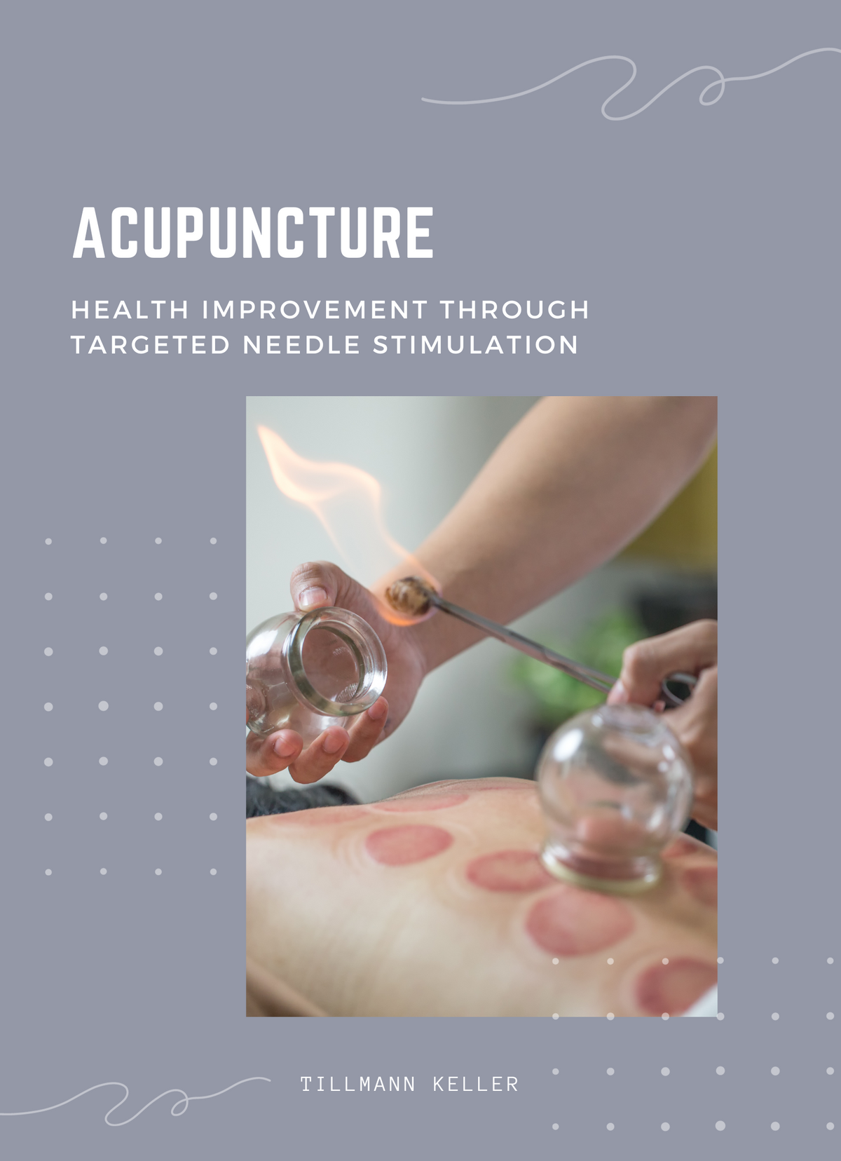 Acupuncture