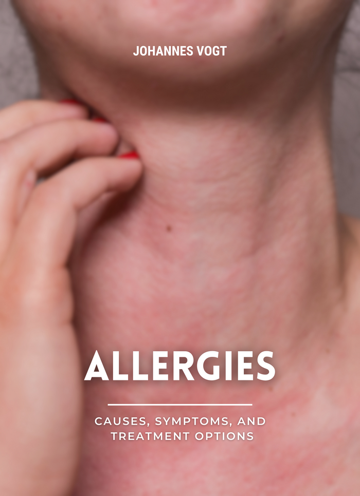 Allergies