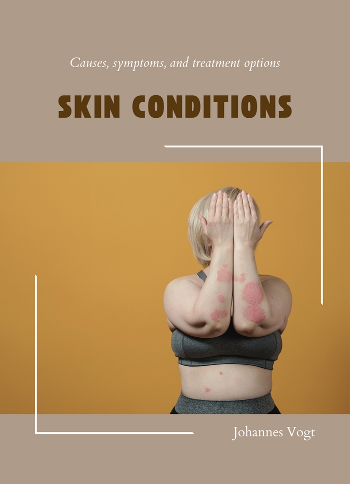 Skin conditions